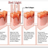 Red Light Therapy Cool Tanz & Spa